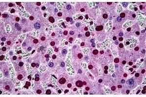Human Liver: Formalin-Fixed, Paraffin-Embedded (FFPE) (SGK1 antibody  (AA 1-91))