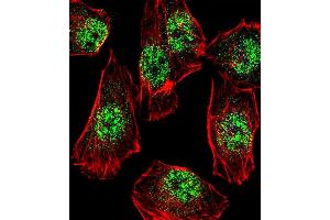 Fluorescent confocal image of A549 cell stained with RHOXF2B Antibody (Center) (ABIN1538705 and ABIN2838200).