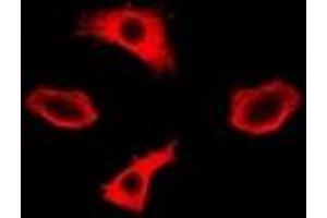Immunofluorescent analysis of IMPA1 staining in A549 cells. (IMPA1 antibody)