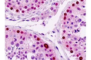 Anti-LSM2 / SnRNP antibody IHC staining of human testis. (LSM2 antibody)