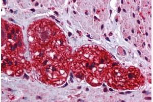 Human Colon, Myenteric Plexus: Formalin-Fixed, Paraffin-Embedded (FFPE) (SOX6 antibody  (C-Term))
