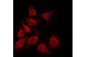 ABIN6269071 staining COS7 by IF/ICC. (ABL1 antibody)