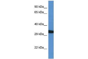 WB Suggested Anti-GFRA4 AntibodyTitration: 1. (GFRA4 antibody  (C-Term))