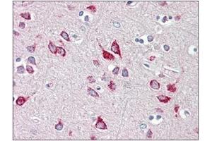 Human Brain, Cortex: Formalin-Fixed, Paraffin-Embedded (FFPE) (HEXB antibody  (C-Term))