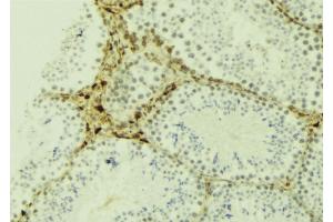 ABIN6274469 at 1/100 staining Mouse testis tissue by IHC-P. (JAKMIP2 antibody  (C-Term))