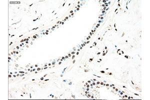 Immunohistochemical staining of paraffin-embedded breast tissue using anti-MAP2K4 mouse monoclonal antibody.