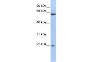 WB Suggested Anti-SUFU Antibody Titration:  0. (SUFUH antibody  (Middle Region))