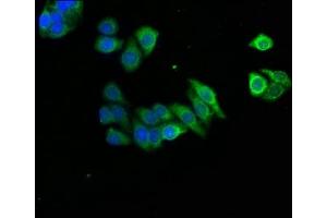 Immunofluorescence staining of HepG2 cells with ABIN7143681 at 1:166, counter-stained with DAPI. (AOX1 antibody  (AA 236-421))