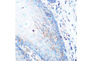Immunohistochemistry of paraffin-embedded human esophageal using HLA-A Rabbit mAb (ABIN7268366) at dilution of 1:100 (40x lens). (HLA-A antibody)