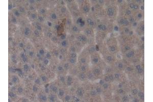 Detection of MMP3 in Rat Liver Tissue using Monoclonal Antibody to Matrix Metalloproteinase 3 (MMP3) (MMP3 antibody  (AA 278-450))