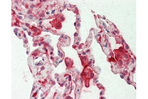 Anti-CAPG / MCP antibody IHC staining of human lung.