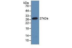 Detection of Recombinant ANGPTL1, Human using Monoclonal Antibody to Angiopoietin-3 (ANG-3) (Angiopoietin 4 antibody  (AA 271-491))