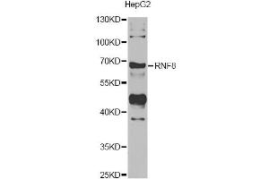Western blot analysis of extracts of HepG2 cells, using RNF8 antibody (ABIN5974404) at 1/1000 dilution. (RNF8 antibody)