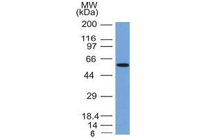 Western Blot Analysis of MCF-7 cell lysate with Occludin Mouse Monoclonal Antibody (OCLN/2181).