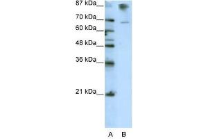 Western Blot showing HKR1 antibody used at a concentration of 1-2 ug/ml to detect its target protein. (HKR1 antibody  (C-Term))