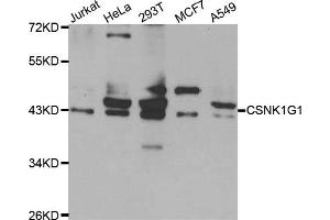 Western blot analysis of extracts of various cell lines, using CSNK1G1 antibody. (CSNK1G1 antibody)