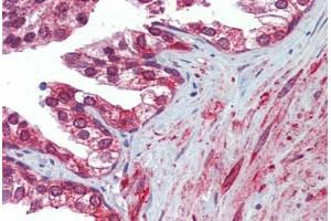 Prostate, Human: Formalin-Fixed, Paraffin-Embedded (FFPE) (Calnexin antibody)