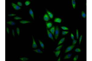 Immunofluorescence staining of Hela Cells with ABIN7127477 at 1:50, counter-stained with DAPI. (Recombinant ERK2 antibody)