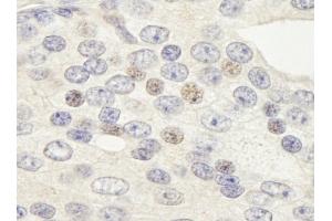 Immunohistochemistry (IHC) image for anti-Zinc Finger Protein 592 (ZNF592) (AA 950-1000) antibody (ABIN7448883) (ZNF592 antibody  (AA 950-1000))