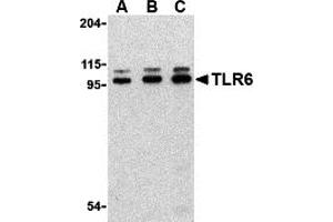 Western Blotting (WB) image for anti-Toll-Like Receptor 6 (TLR6) (Middle Region) antibody (ABIN1031130) (TLR6 antibody  (Middle Region))