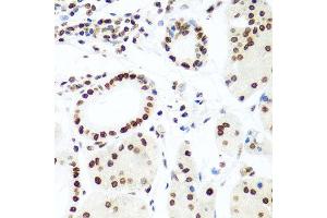 Immunohistochemistry of paraffin-embedded human gastric using H2AFX antibody at dilution of 1:100 (x40 lens). (H2AFX antibody)