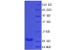 SDS-PAGE (SDS) image for Mismatch Repair Protein 2 (MSH2) (AA 139-311) protein (His tag) (ABIN5709307) (MSH2 Protein (AA 139-311) (His tag))