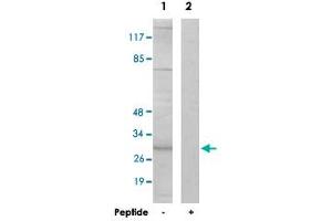 Western blot analysis of extracts from HeLa cells, using SPIN1 polyclonal antibody . (Spindlin 1 antibody)