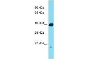 Western Blotting (WB) image for anti-Regulator of Chromosome Condensation (RCC1) and BTB (POZ) Domain Containing Protein 1 (RCBTB1) (N-Term) antibody (ABIN2790441) (RCBTB1 antibody  (N-Term))