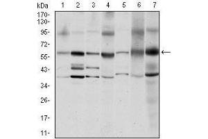 Western blot analysis using SRC mouse mAb against MCF-7 (1), A431 (2), Hela (3), HEK293 (4), NIH/3T3 (5), PC-12 (6) and Cos7 (7) cell lysate. (Src antibody)