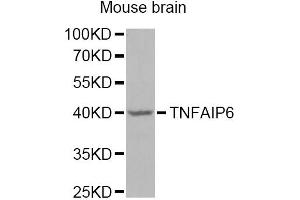 Western blot analysis of extracts of mouse brain, using TNFAIP6 Antibody (ABIN5975410) at 1/1000 dilution. (TNFAIP6 antibody)