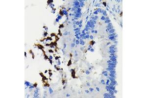 Immunohistochemistry of paraffin-embedded human colon carcinoma using FADD Rabbit mAb (ABIN7267135) at dilution of 1:100 (40x lens). (FADD antibody)