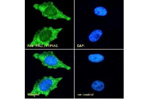 (ABIN185274) Immunofluorescence analysis of paraformaldehyde fixed HeLa cells, permeabilized with 0. (PTP4A1 antibody  (C-Term))