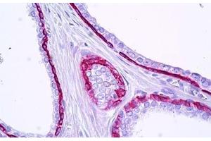 Anti-KRT15 / Cytokeratin 15 antibody IHC staining of human prostate, epithelium. (KRT15 antibody  (AA 1-50))