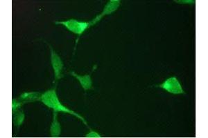 Immunofluorescent staining of LNCaP cells (Prostate Specific Antigen antibody)