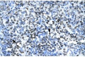 Human Spleen; CLDN17 antibody - middle region in Human Spleen cells using Immunohistochemistry (Claudin 17 antibody  (Middle Region))