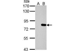 WB Image Sample (30 ug of whole cell lysate) A: Non-transfected 293T lysates B: hSLU7 transfected 293T lysates 7. (SLU7 antibody  (C-Term))