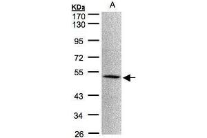 WB Image Sample(30 μg of whole cell lysate) A:293T 10% SDS PAGE antibody diluted at 1:1000 (MOK antibody)