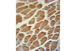 ACADL Antibody immunohistochemistry analysis in formalin fixed and paraffin embedded human skeletal muscle followed by peroxidase conjugation of the secondary antibody and DAB staining. (ACADL antibody  (AA 292-319))