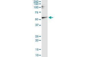 CNR1 monoclonal antibody (M02), clone 1F9. (CNR1 antibody  (AA 1-110))