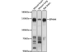Western blot analysis of extracts of various cell lines, using EPH antibody (ABIN6132064, ABIN6140215, ABIN6140216 and ABIN6224369) at 1:1000 dilution. (EPH Receptor A4 antibody  (AA 887-986))