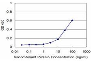 Detection limit for recombinant GST tagged MAP3K5 is approximately 3ng/ml as a capture antibody. (ASK1 antibody  (AA 1231-1374))