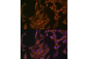 Immunofluorescence analysis of NIH-3T3 cells using Zyxin Rabbit mAb (ABIN1682627, ABIN3015962, ABIN3015963 and ABIN7101467) at dilution of 1:100 (40x lens). (ZYX antibody)