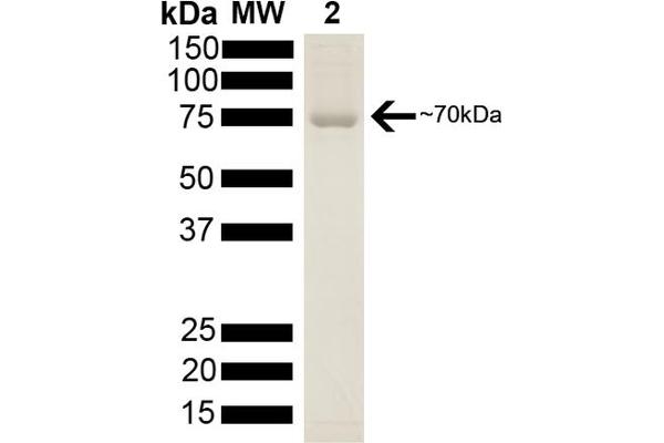 HSP70 Protein (His tag)