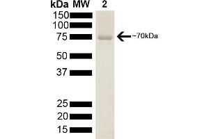 SDS-PAGE of 70 kDa Hsp70 protein (ABIN1686669, ABIN1686670 and ABIN1686671).