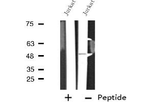 Western blot analysis of extracts from Jurkat cells, using ALS2CR4 antibody. (TMEM237 antibody  (Internal Region))