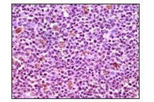 Immunohistochemical analysis of paraffin-embedded human lymphnode tissues using MCL1 mouse mAb with DAB staining. (MCL-1 antibody)