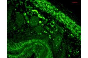 Immunohistochemistry analysis using Mouse Anti-CD74 Monoclonal Antibody, Clone PIN 1. (CD74 antibody)