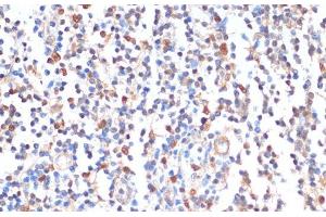 Immunohistochemistry of paraffin-embedded Human tonsil using ZMYM3 Polyclonal Antibody at dilution of 1:100 (40x lens). (ZMYM3 antibody)