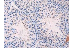 Immunohistochemistry (IHC) image for anti-alpha-2-HS-Glycoprotein (AHSG) (AA 19-250) antibody (ABIN7429511)