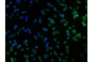 Immunofluorescence staining of Jurkat cells with ABIN7148445 at 1:166, counter-stained with DAPI. (CNKSR2 antibody  (AA 650-800))